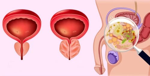 Urotrin farmacia del ahorro