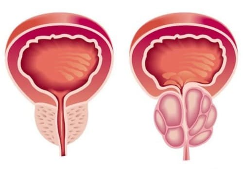 Urotrin medicamento opiniones