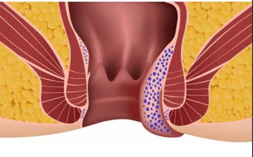 Gelarex para que sirve